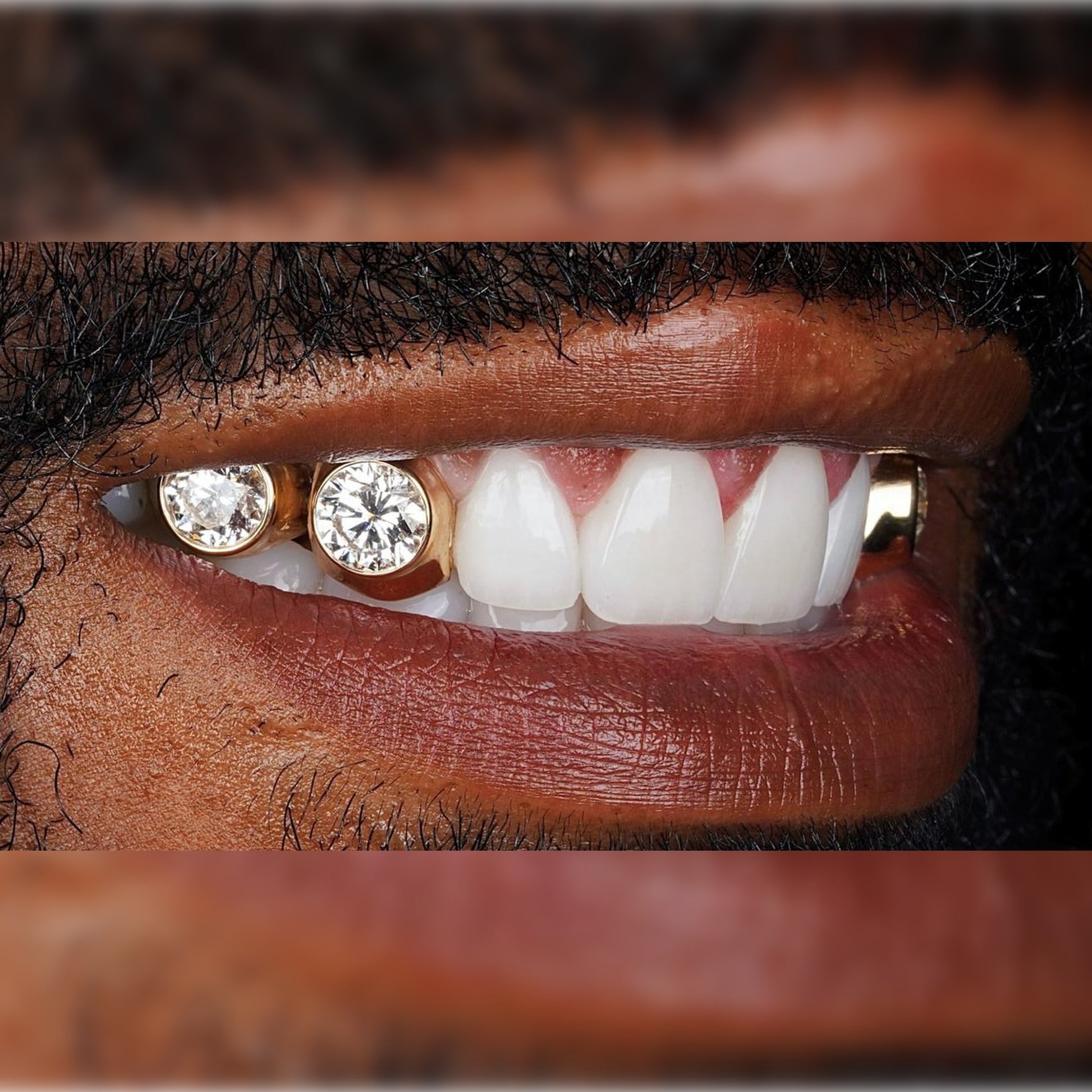 Diamond Customization